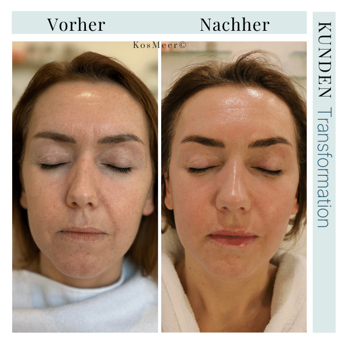 NEW AGE GESICHTSBEHANDLUNG