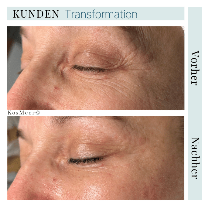 ÄSTHETISCHE GESICHTSMASSAGE