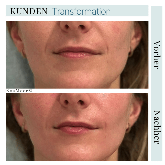 BUCCAL MASSAGE