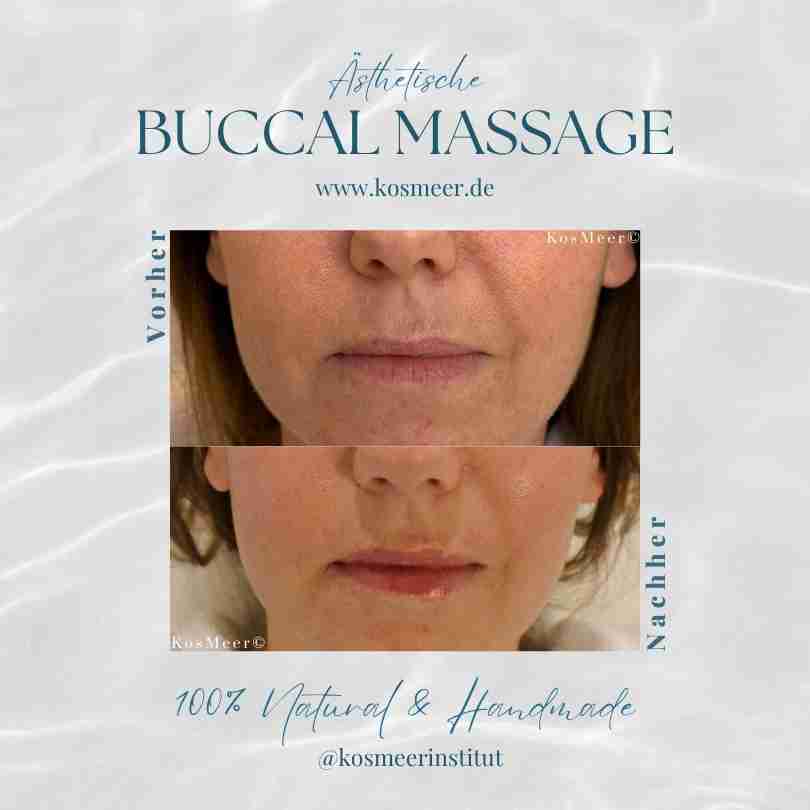 Ästhetische Buccal Massage Vorher Nachher Ergebnis KosMeer Institut KosMeer©