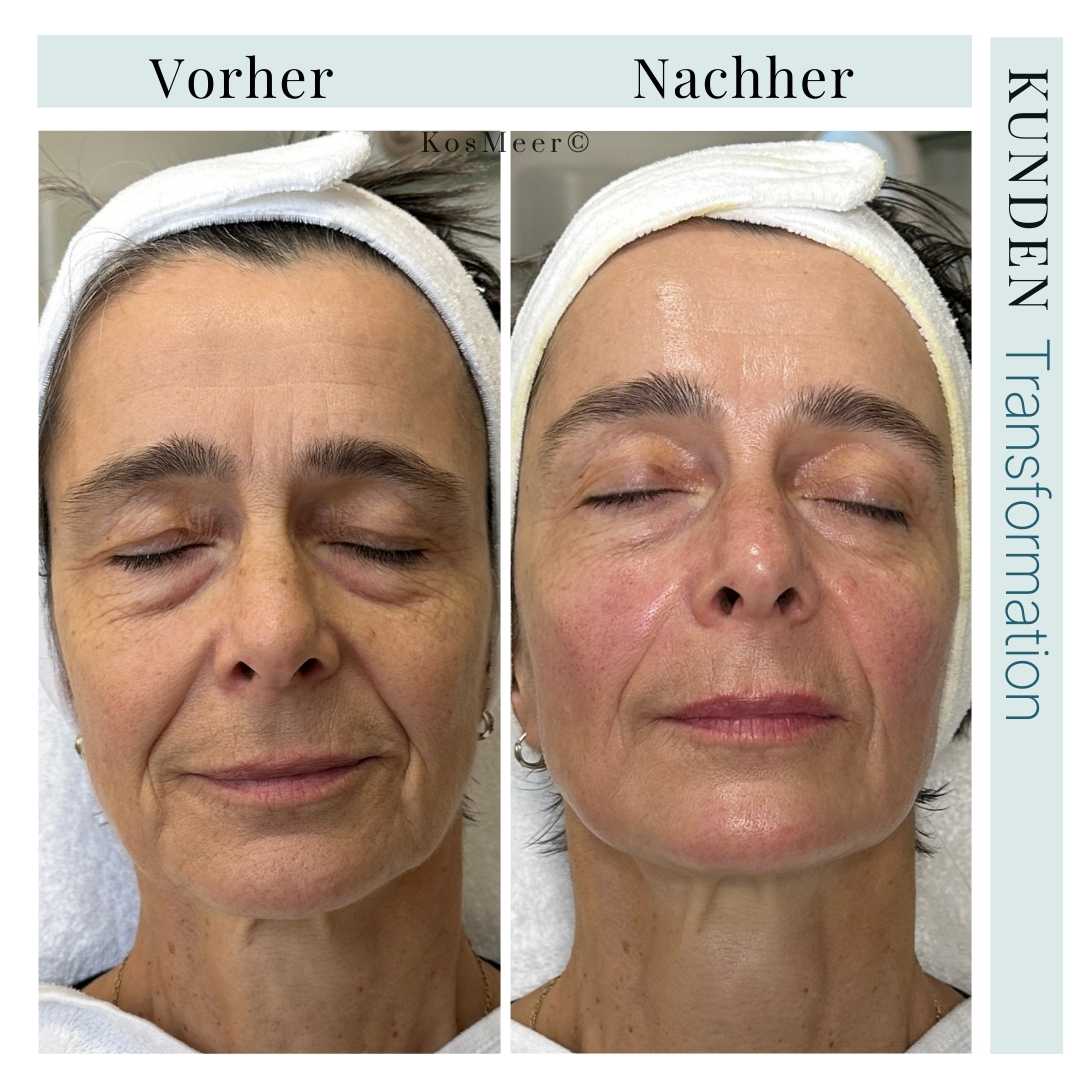NEW AGE GESICHTSBEHANDLUNG