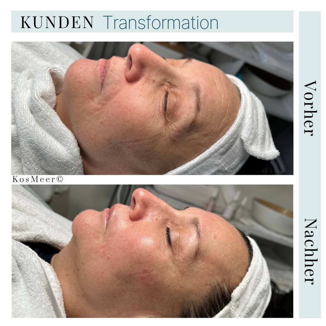 NEW AGE GESICHTSBEHANDLUNG