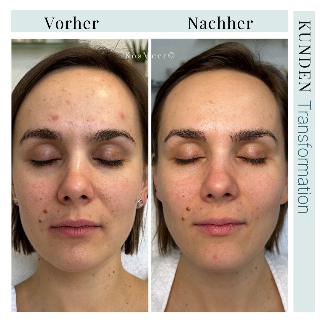 NEW AGE GESICHTSBEHANDLUNG