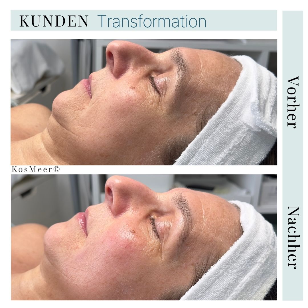 ÄSTHETISCHE GESICHTSMASSAGE