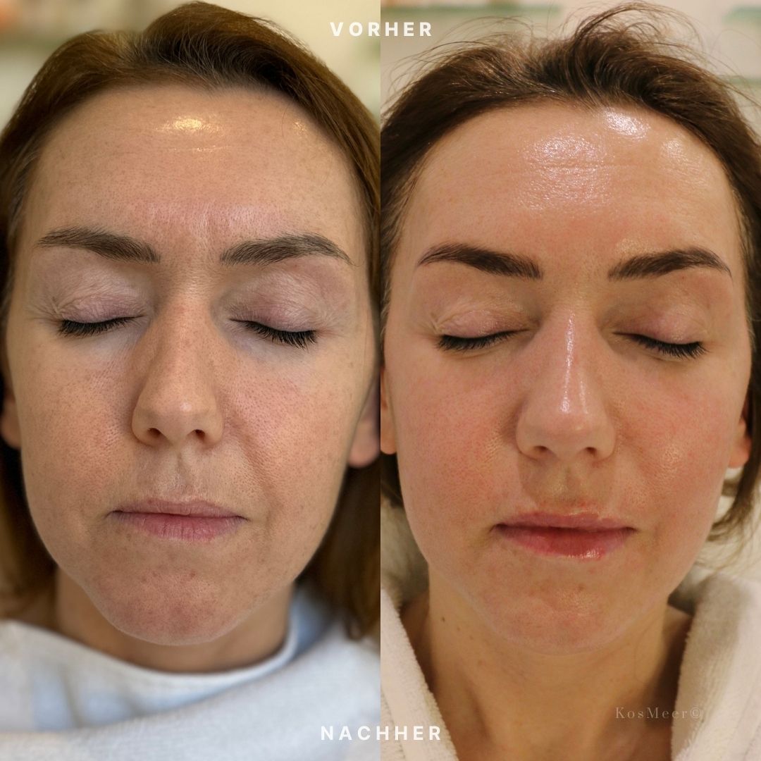 Kosmeer New Age Gesichtsbehandlung natürliche gesichtsverjüngung ästhetische gesichtsmassage KosMeer©