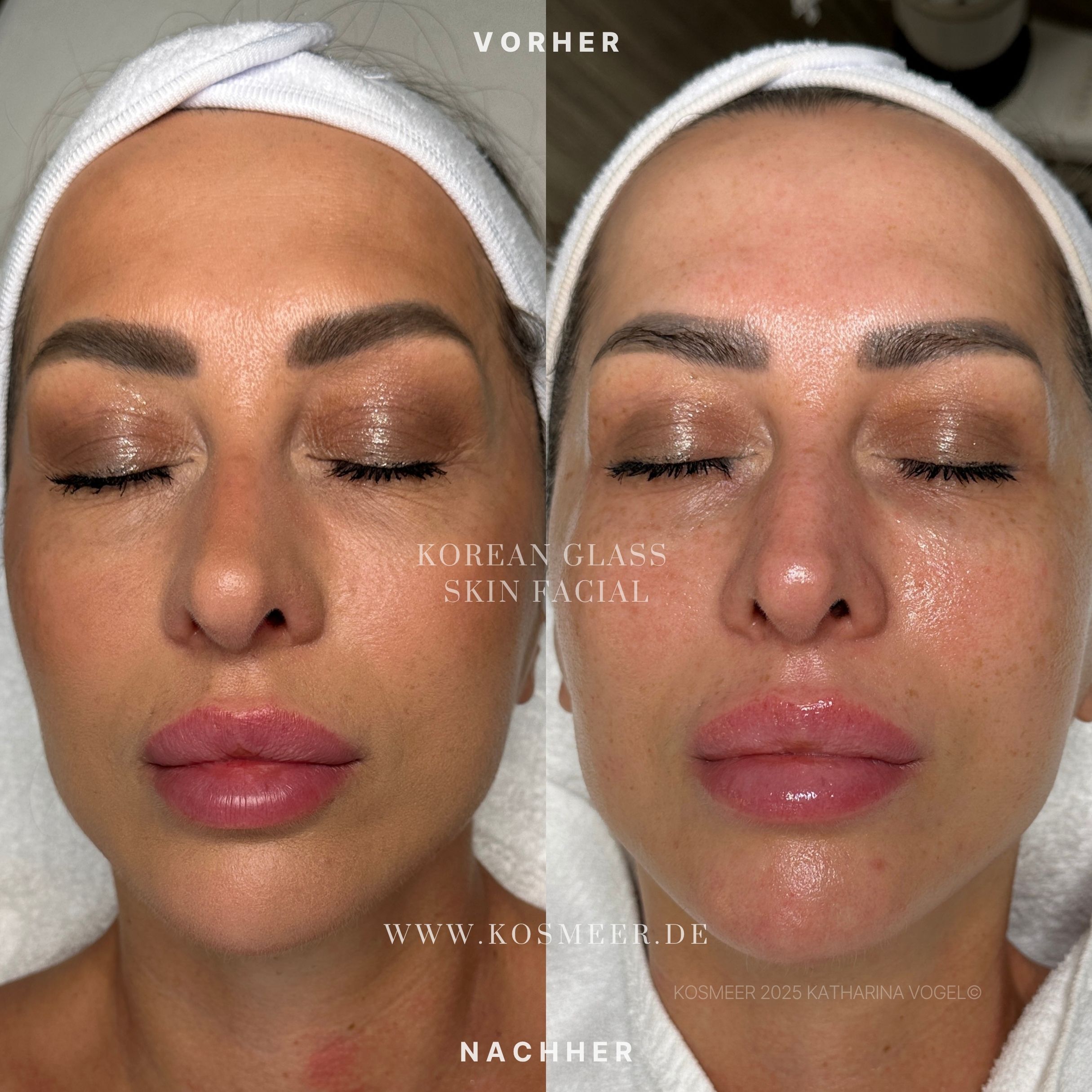 Korean Glass Skin Facial Gesichtsbehandlung Kosmeer Institut Katharina Vogel©