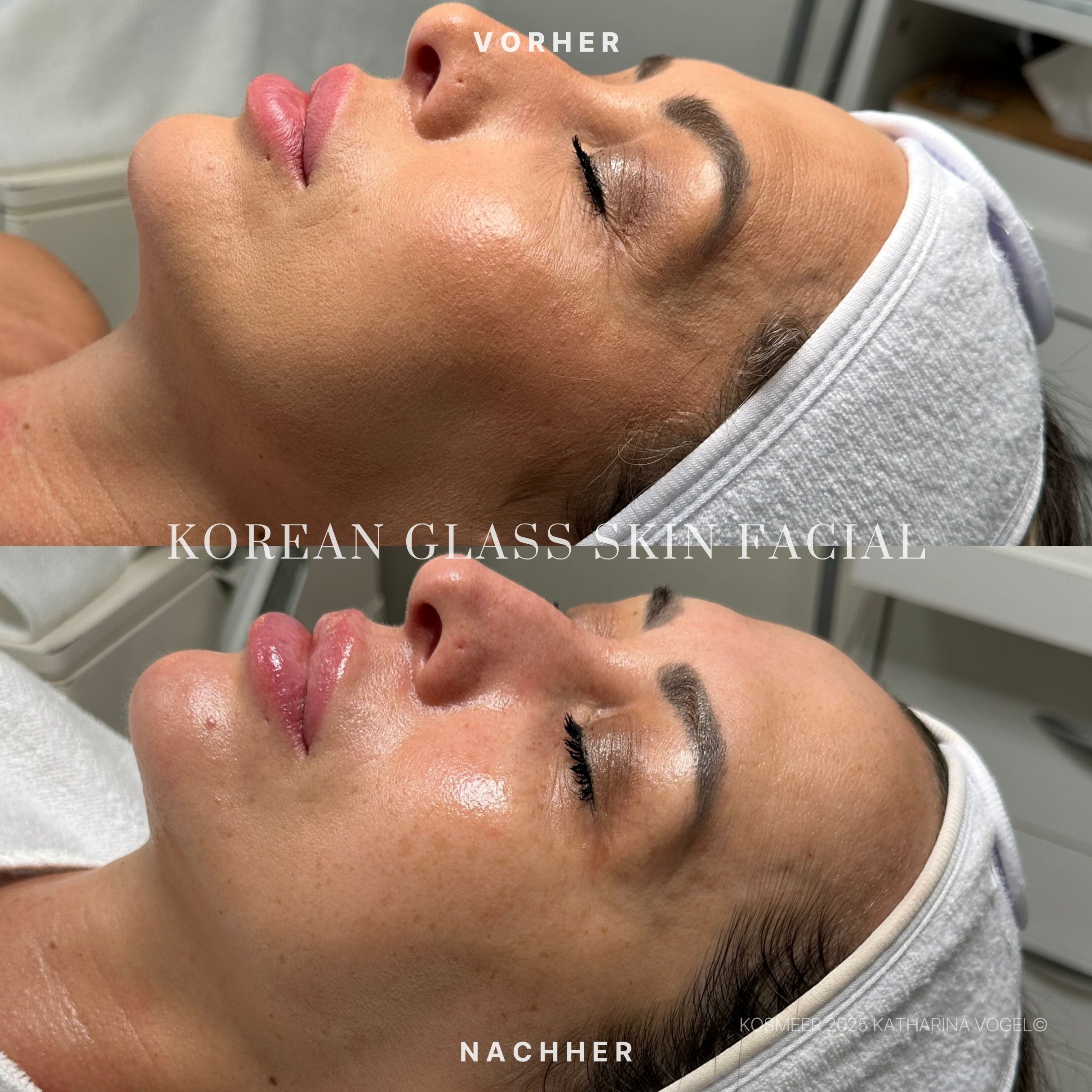 Korean Glass Skin Facial Gesichtsbehandlung KosMeer Institut Katharina Vogel©