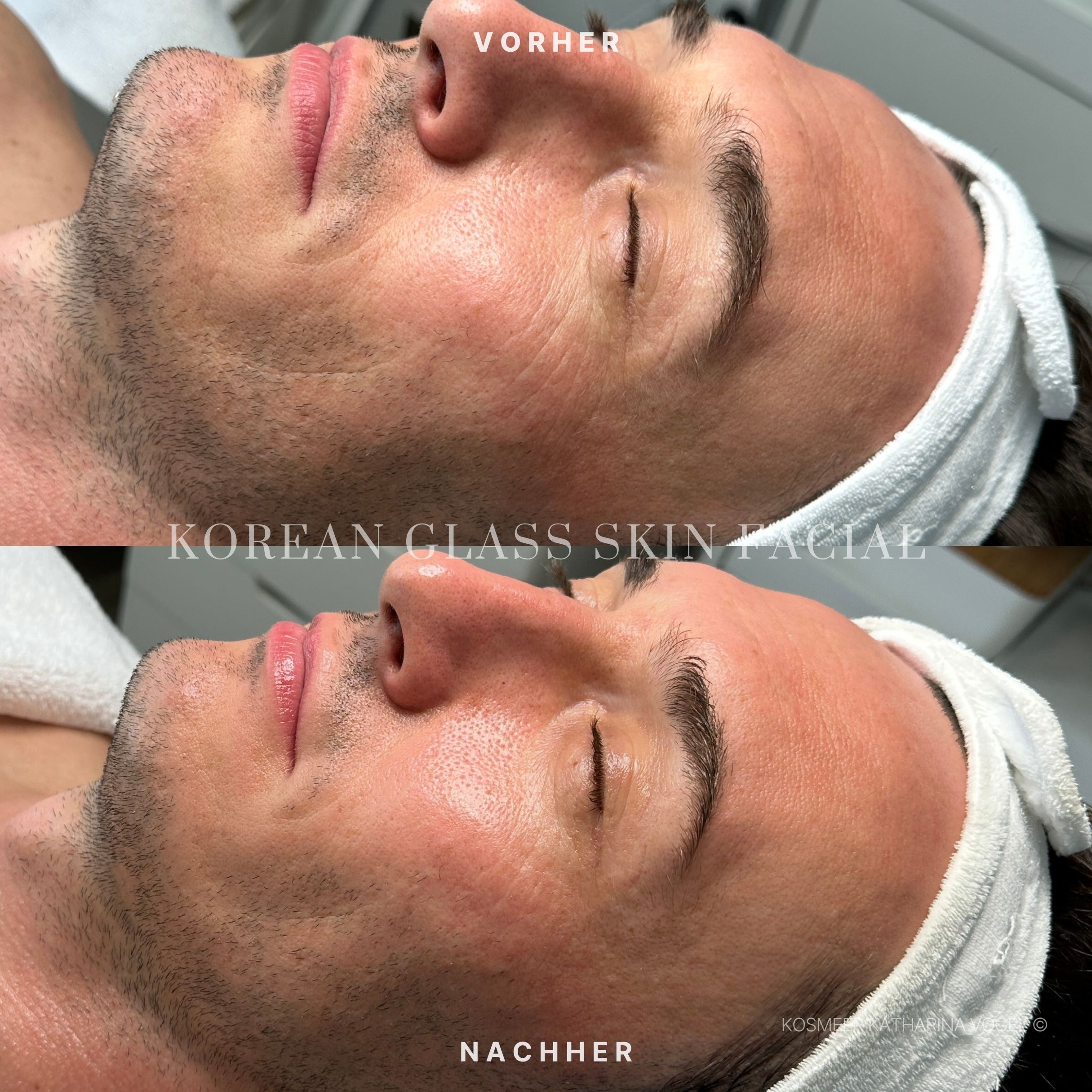 Korean Glass Skin Facial Gesichtsbehandlung KosMeer Institut Katharina Vogel©
